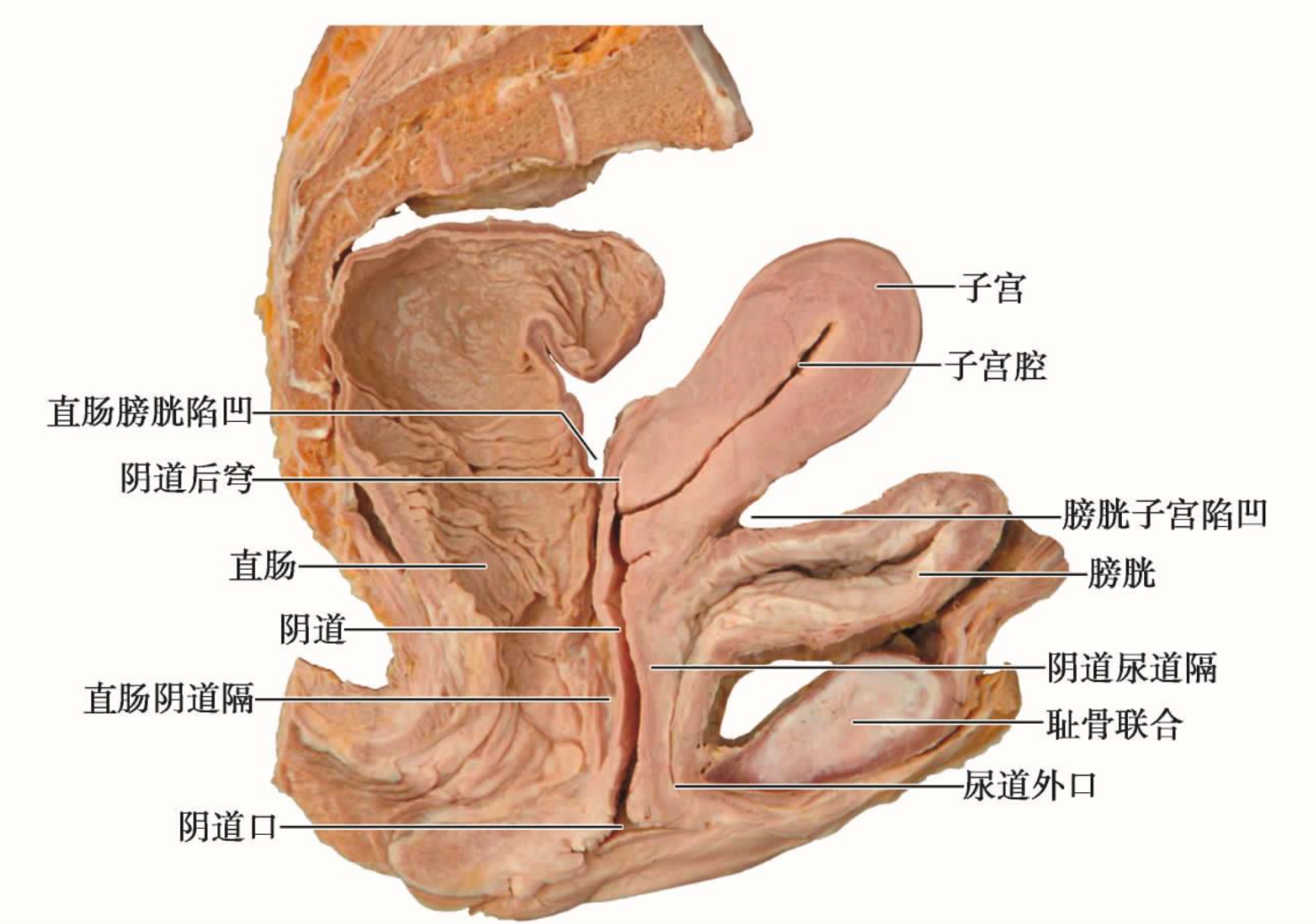 火炮——”梦无花果(0级/+2级)”评测!摸起来手感很有趣的黏膜概念杯,不过似乎并没有太多实际体验上的作用
